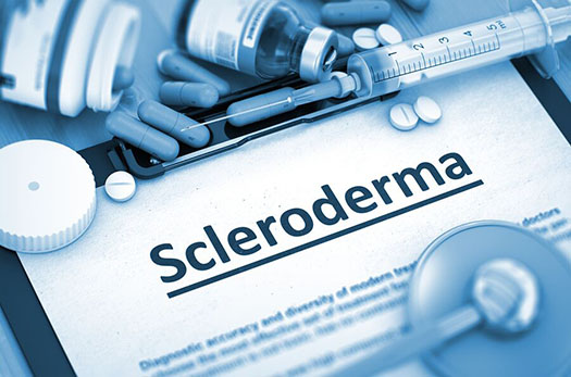 Home Care in Santa Monica CA: Scleroderma Awareness Month